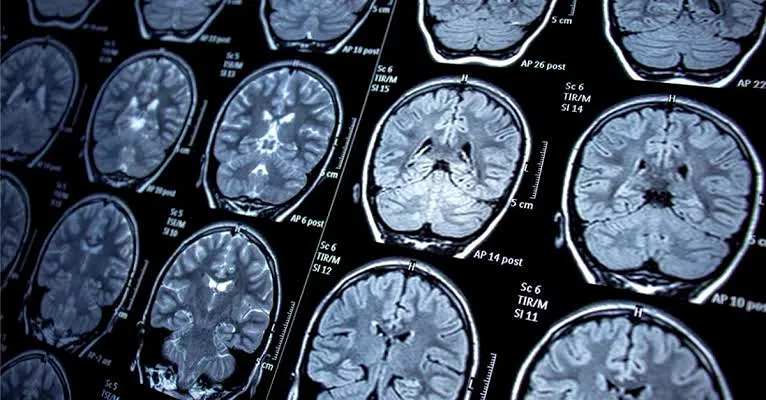 Brain Specialist in Kanpur