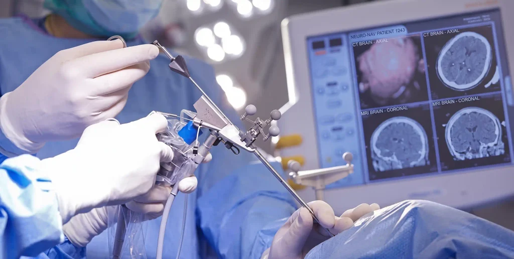 Neurosurgery Specialist in Kanpur